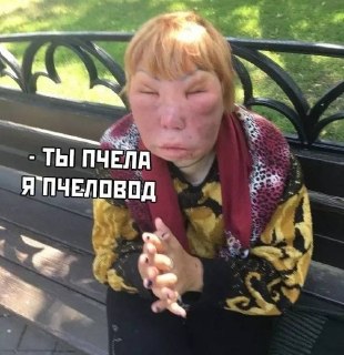 Сосед-пчеловод заплатит 20 тыс. рублей за укус пчелы